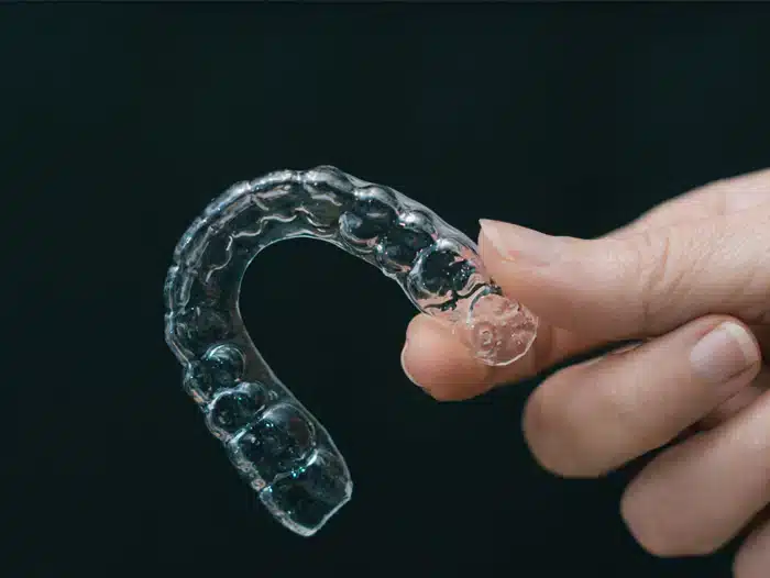 Invisalign Cost in Ventura, CA - The Smile Shapers