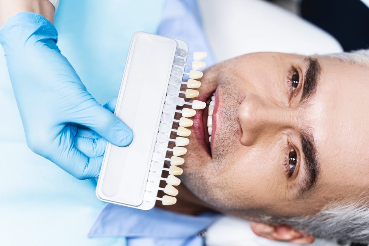Veneers in Ventura